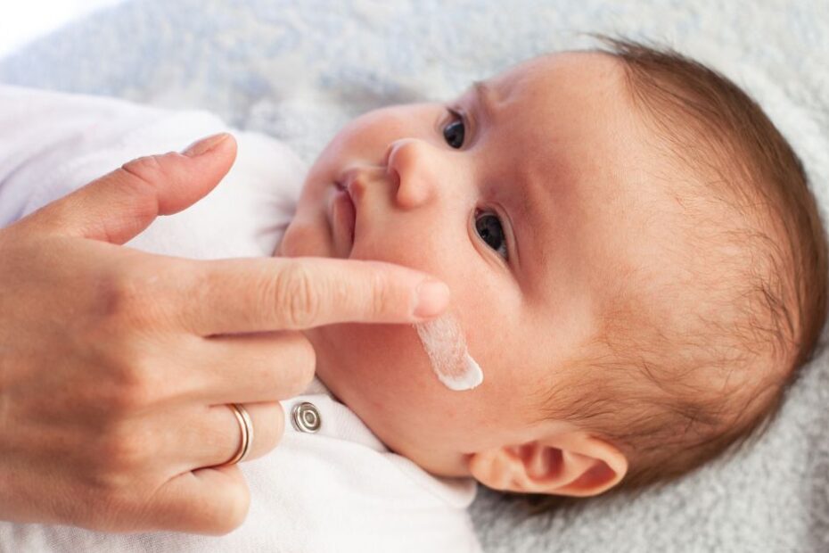 Atopický ekzém u bábätiek: Komplexný sprievodca od príznakov po liečbu