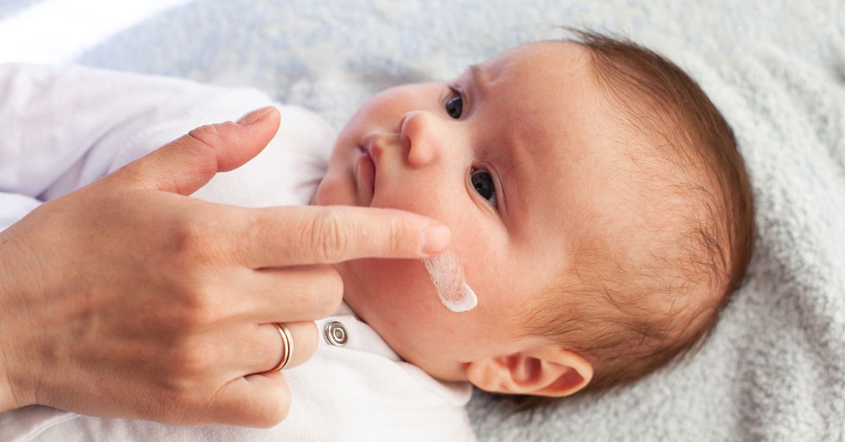 Atopický ekzém u bábätiek: Komplexný sprievodca od príznakov po liečbu