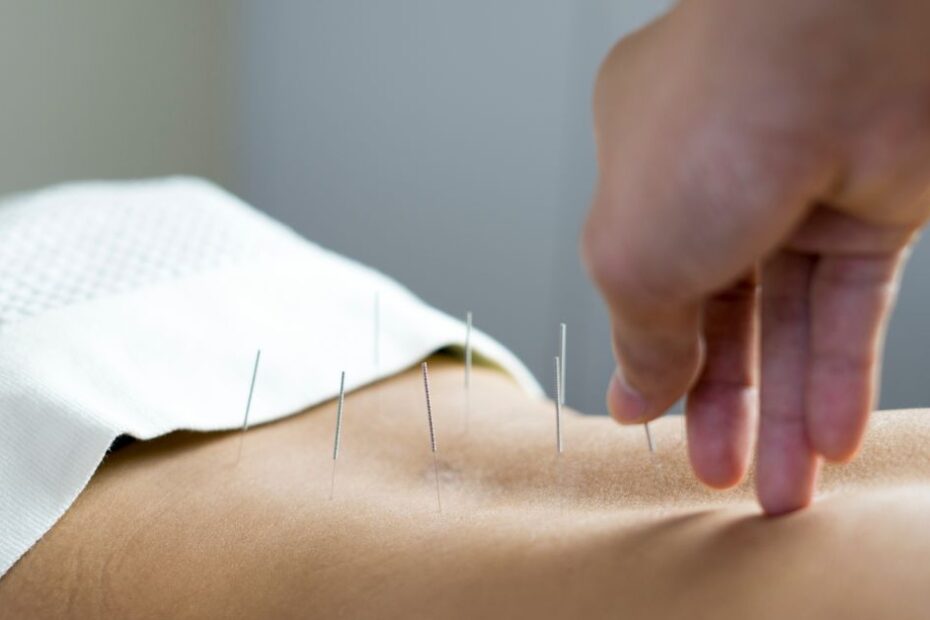 Akupunktúra na ceste k otehotneniu. Starodávna metóda s modernými dôkazmi